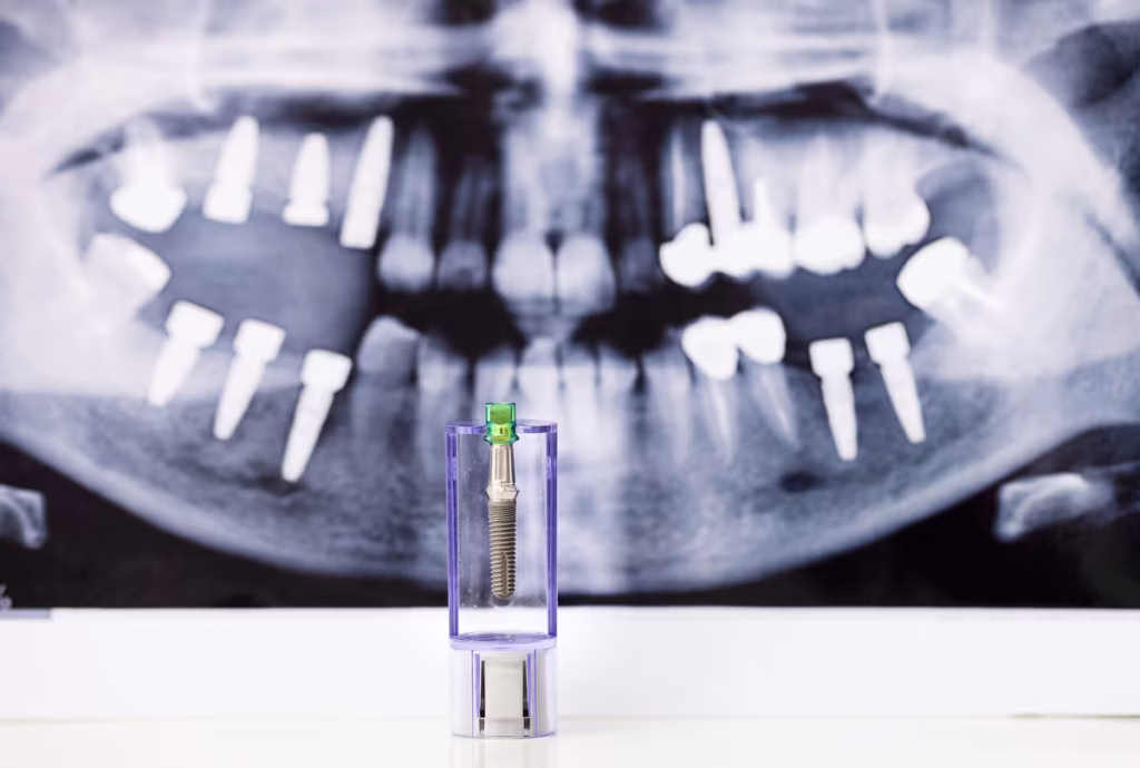 When marketing implant dentistry, meet dental implant patients at the point of intent.