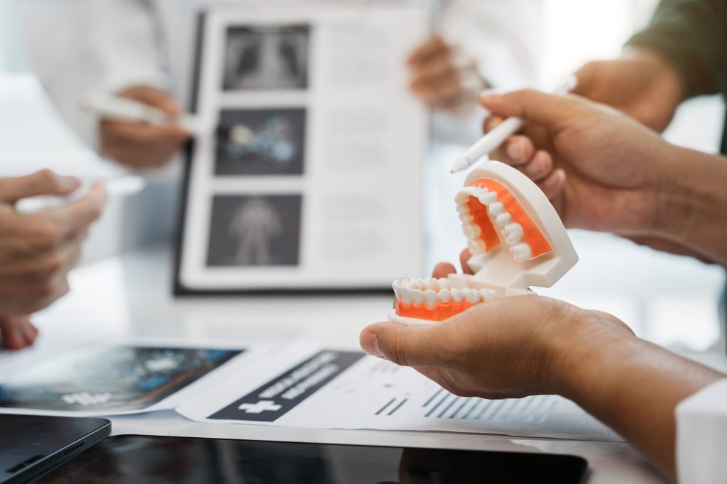 Dental implant marketing strategy showing four patient segments - single-tooth, full-arch, denture-converter, and confidence-lost - with segment-specific marketing approaches